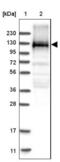 EMAP Like 4 antibody, NBP1-86805, Novus Biologicals, Western Blot image 