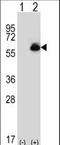 Aldehyde Dehydrogenase 4 Family Member A1 antibody, LS-C97487, Lifespan Biosciences, Western Blot image 