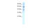 Potassium Voltage-Gated Channel Subfamily D Member 3 antibody, 28-250, ProSci, Western Blot image 