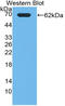 Phosphatidylinositol-4-Phosphate 3-Kinase Catalytic Subunit Type 2 Alpha antibody, LS-C372515, Lifespan Biosciences, Western Blot image 