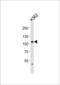 eIF-4G 2 antibody, 61-051, ProSci, Western Blot image 