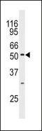 Mitogen-Activated Protein Kinase 10 antibody, LS-C100712, Lifespan Biosciences, Western Blot image 