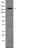 FA Complementation Group D2 antibody, PA5-64826, Invitrogen Antibodies, Western Blot image 