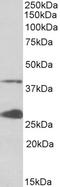 Uroporphyrinogen Decarboxylase antibody, EB11955, Everest Biotech, Western Blot image 