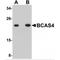 Breast Carcinoma Amplified Sequence 4 antibody, MBS150779, MyBioSource, Western Blot image 