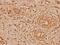 Cystatin B antibody, GTX66627, GeneTex, Immunohistochemistry paraffin image 