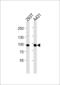 Interleukin 4 Receptor antibody, 61-028, ProSci, Western Blot image 