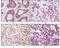 Inhibitor Of Nuclear Factor Kappa B Kinase Subunit Beta antibody, MA5-15320, Invitrogen Antibodies, Immunohistochemistry frozen image 