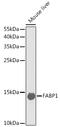 Fatty Acid Binding Protein 1 antibody, 19-579, ProSci, Western Blot image 