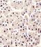 Glutamic--Pyruvic Transaminase antibody, MBS9207377, MyBioSource, Immunohistochemistry paraffin image 