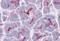 SLAIN Motif Family Member 1 antibody, A13403, Boster Biological Technology, Immunohistochemistry paraffin image 