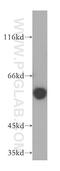Choline Dehydrogenase antibody, 17356-1-AP, Proteintech Group, Western Blot image 