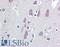 Vacuolar Protein Sorting 25 Homolog antibody, LS-B2409, Lifespan Biosciences, Immunohistochemistry paraffin image 