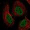 RB Binding Protein 4, Chromatin Remodeling Factor antibody, NBP2-56286, Novus Biologicals, Immunofluorescence image 