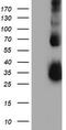 TIMP Metallopeptidase Inhibitor 2 antibody, CF504312, Origene, Western Blot image 