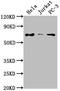 Prickle Planar Cell Polarity Protein 3 antibody, CSB-PA018678PA01HU, Cusabio, Western Blot image 