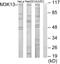 Mitogen-Activated Protein Kinase Kinase Kinase 13 antibody, LS-C118677, Lifespan Biosciences, Western Blot image 