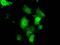 Cilia And Flagella Associated Protein 298 antibody, MA5-25158, Invitrogen Antibodies, Immunocytochemistry image 