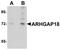 Rho GTPase-activating protein 18 antibody, orb89855, Biorbyt, Western Blot image 