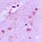 Nucleophosmin 1 antibody, orb214332, Biorbyt, Immunohistochemistry paraffin image 