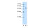 Cilia And Flagella Associated Protein 45 antibody, 30-722, ProSci, Enzyme Linked Immunosorbent Assay image 