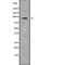 Neuroligin 2 antibody, abx217191, Abbexa, Western Blot image 