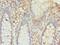 General Transcription Factor IIIC Subunit 6 antibody, LS-C378971, Lifespan Biosciences, Immunohistochemistry paraffin image 