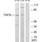 TATA-Box Binding Protein Associated Factor 5 Like antibody, A11343, Boster Biological Technology, Western Blot image 
