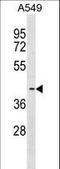 Fatty Acid Desaturase 3 antibody, LS-C159587, Lifespan Biosciences, Western Blot image 