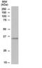 TIR Domain Containing Adaptor Protein antibody, NB300-990, Novus Biologicals, Western Blot image 