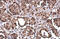 Protein Arginine Methyltransferase 1 antibody, GTX630187, GeneTex, Immunohistochemistry paraffin image 