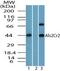 STE20 Related Adaptor Beta antibody, PA5-23276, Invitrogen Antibodies, Western Blot image 