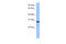 Nucleoporin 35 antibody, 30-840, ProSci, Western Blot image 