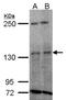 Tyrosine Kinase 2 antibody, NBP1-32450, Novus Biologicals, Western Blot image 