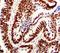 MutS Homolog 2 antibody, LS-C312105, Lifespan Biosciences, Immunohistochemistry frozen image 
