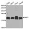 NME/NM23 Nucleoside Diphosphate Kinase 1 antibody, A0259, ABclonal Technology, Western Blot image 