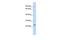 Transmembrane O-methyltransferase antibody, GTX45273, GeneTex, Western Blot image 