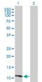 Matrix Gla Protein antibody, H00004256-D01P, Novus Biologicals, Western Blot image 