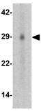 GLI Pathogenesis Related 1 antibody, GTX17212, GeneTex, Western Blot image 