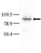 Mitogen-Activated Protein Kinase Kinase Kinase Kinase 3 antibody, PA5-15227, Invitrogen Antibodies, Western Blot image 