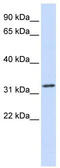 Tropomyosin alpha-1 chain antibody, TA346063, Origene, Western Blot image 