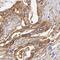 UDP-Glucose Glycoprotein Glucosyltransferase 1 antibody, FNab09236, FineTest, Immunohistochemistry paraffin image 