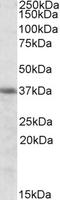 Heme Oxygenase 2 antibody, EB09483, Everest Biotech, Western Blot image 