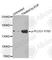 Phospholipase C Gamma 1 antibody, AP0164, ABclonal Technology, Western Blot image 