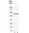 CD2 Molecule antibody, R32420, NSJ Bioreagents, Western Blot image 