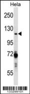 Poly(ADP-Ribose) Polymerase 1 antibody, 56-978, ProSci, Western Blot image 