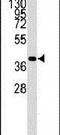 Chondromodulin antibody, PA5-12307, Invitrogen Antibodies, Western Blot image 