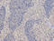 Dynamin 1 Like antibody, A00556-1, Boster Biological Technology, Immunohistochemistry paraffin image 