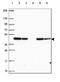 NADH:Ubiquinone Oxidoreductase Core Subunit S2 antibody, HPA061953, Atlas Antibodies, Western Blot image 