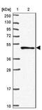 Sorting Nexin 5 antibody, NBP2-38641, Novus Biologicals, Western Blot image 